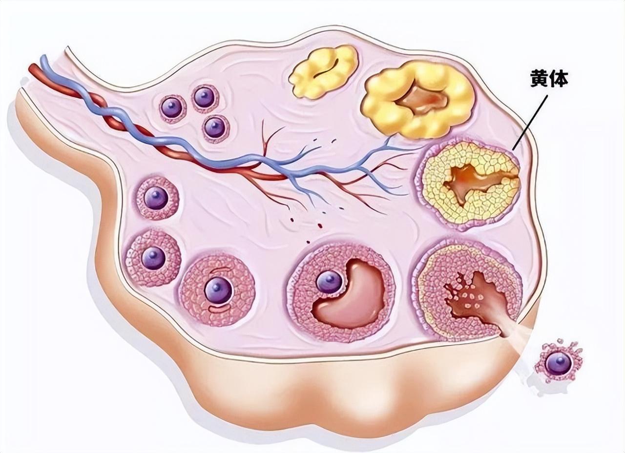 黃體破裂的預防措施，了解、預防與保護女性健康，黃體破裂的預防措施，女性健康保護指南