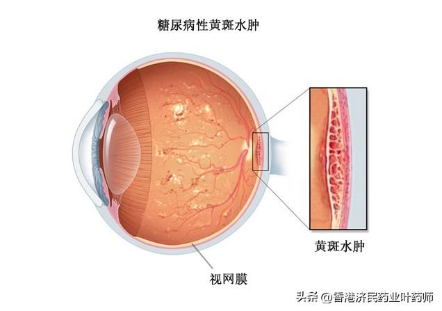 軍校視力要求最新標準2024，2024年軍校視力要求最新標準解析