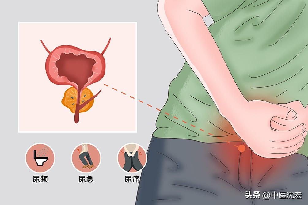 前列腺炎的成因解析，前列腺炎成因深度解析