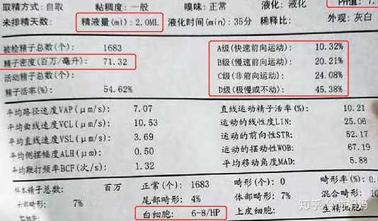 精子報告解讀，重點關注哪幾個數值？，解讀精子報告，重點關注數值詳解