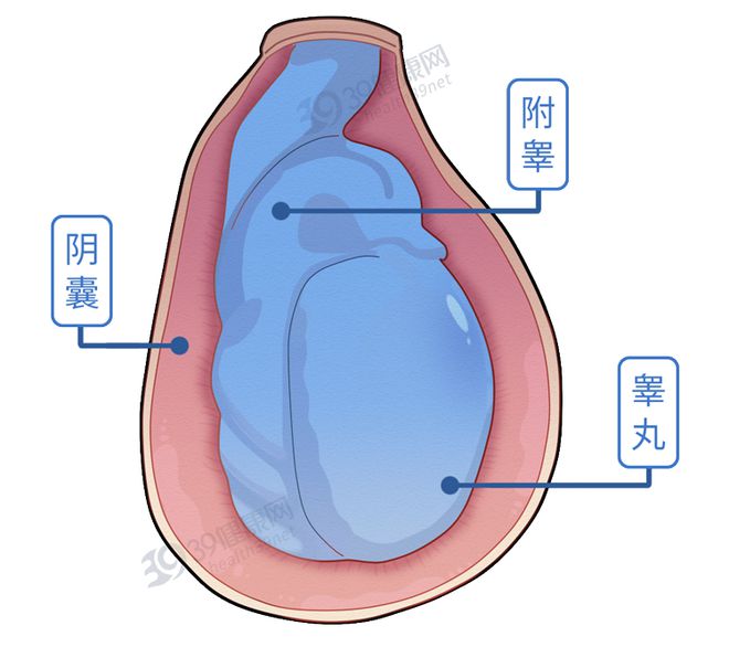 睪丸囊腫